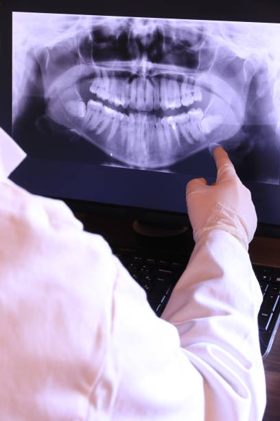 Best Emergency Treatment for Dental Infections or Abscesses in St Matthews, KY